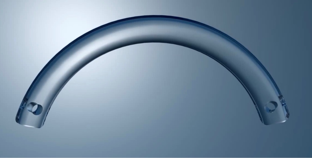 ICRS (Intracorneal Ring Segments) for Keratoconus